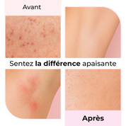 Résultat avant/après de l’utilisation de l’huile LumiSilk - Réduction visible des irritations post-rasage.