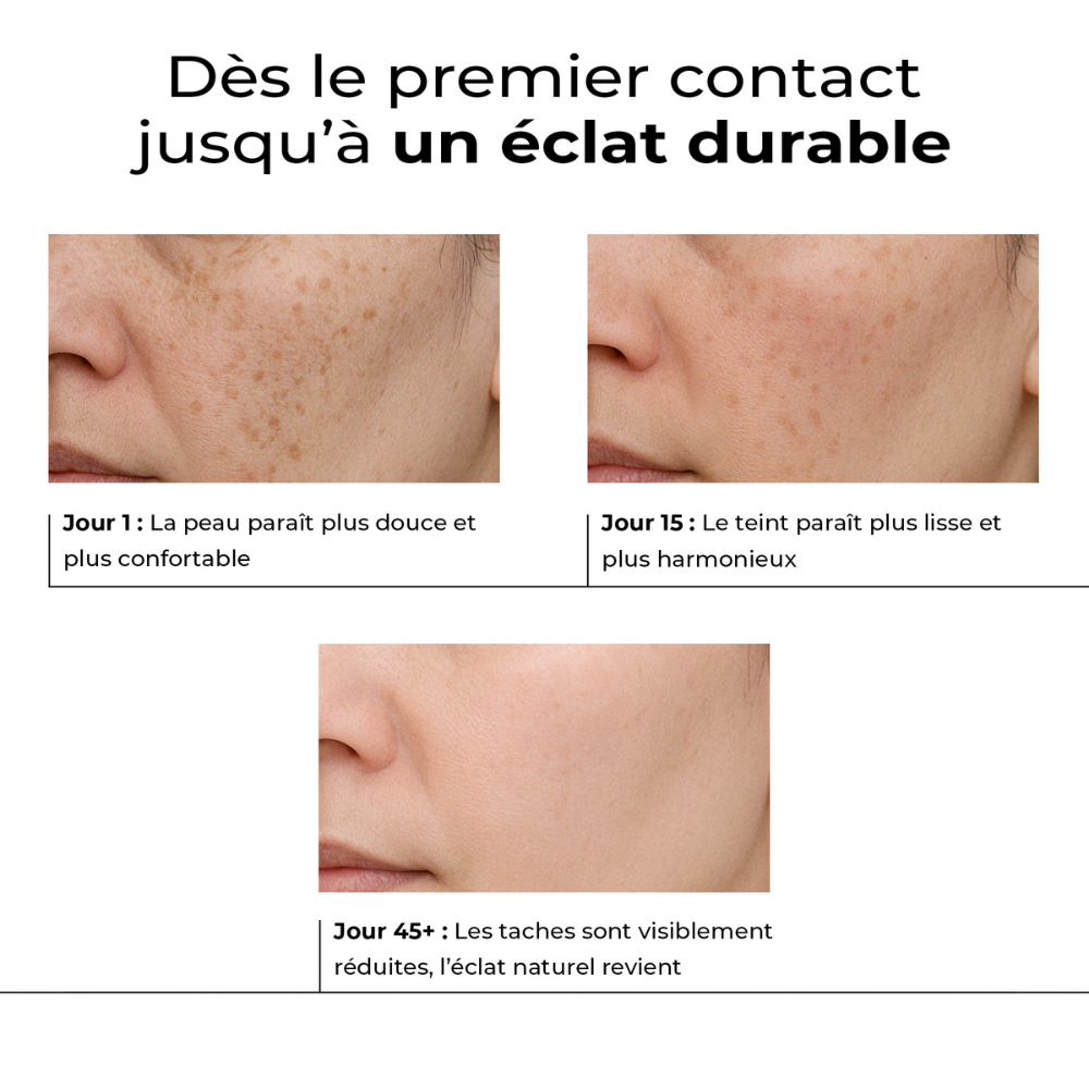 Évolution du teint avec Lumen Drop : dès le Jour 1 jusqu’au Jour 45+, peau plus douce, uniforme et lumineuse