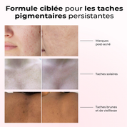 Résultats du sérum Lumen Drop sur les taches pigmentaires : post-acné, soleil, âge – peau visiblement plus claire